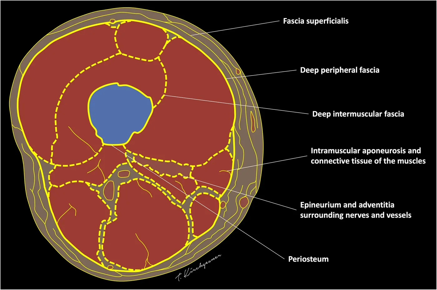 Schematic transverse section of the thigh showing its fascial anatomy